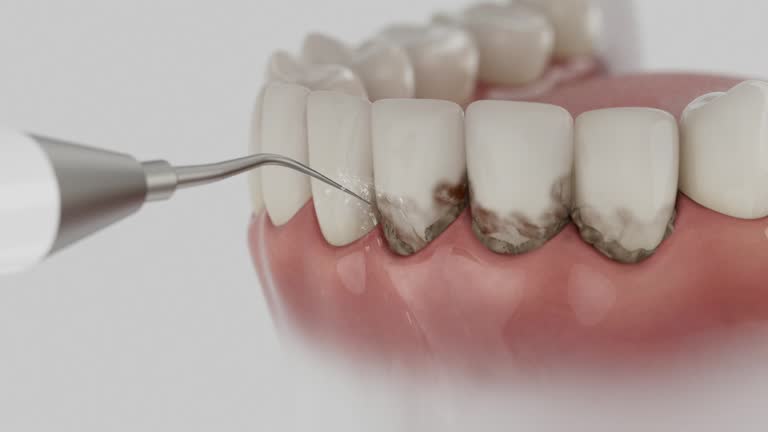 Reliable Tooth Extraction contractor in Williamson, AZ by Smile Center Dentistry